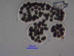 Microcystis wesenbergii