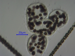 Microcystis wesenbergii