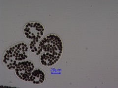 Microcystis wesenbergii
