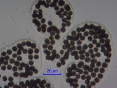 Microcystis wesenbergii