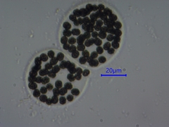 Microcystis wesenbergii
