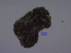 Microcystis aeruginosa