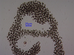 Microcystis aeruginosa