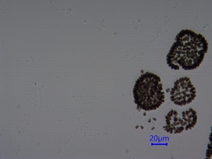 Woronichinia