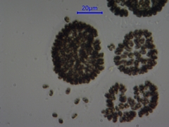 Woronichinia