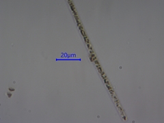 Aphanizomenon flosaquae