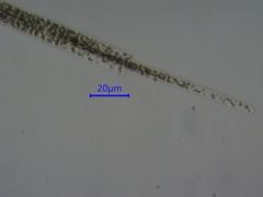 Aphanizomenon flosaquae