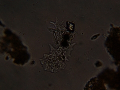 Amoebidae