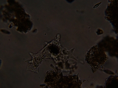 Amoebidae