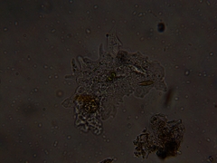 Amoebidae
