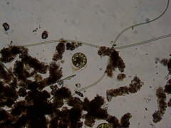 Amoebidae
