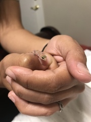 Hemidactylus turcicus