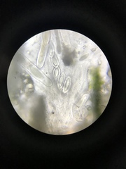 Pertusaria paratuberculifera