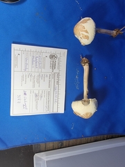 Chlorophyllum molybdites