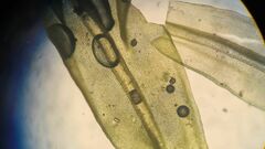 Leptodontium paradoxum