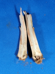 Chlorophyllum molybdites