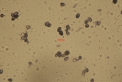Melanoleuca graminicola