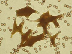 Physarum auriscalpium