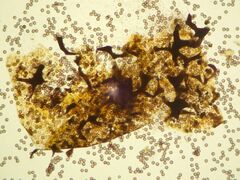 Physarum auriscalpium