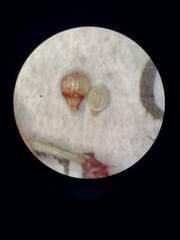 Fimbristylis