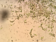 Chaenotheca furfuracea