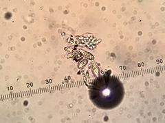 Thelidium pyrenophorum