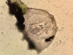 Thelidium pyrenophorum