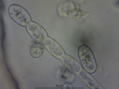 Podosphaera clandestina