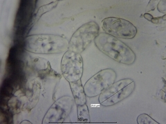 Podosphaera clandestina