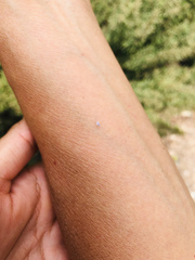 Corythucha marmorata