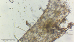 Cymbella