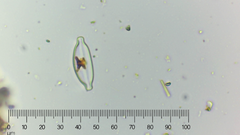 Encyonopsis microcephala