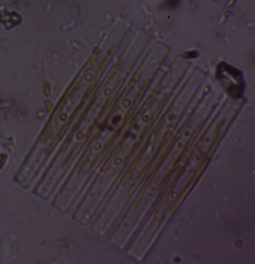 Fragilaria