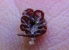 Dermacentor variabilis
