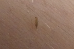 Thysanoptera