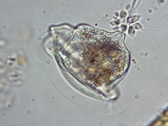 Vorticella