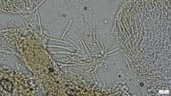 Trichoderma peltatum