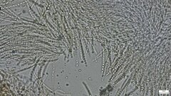 Trichoderma peltatum