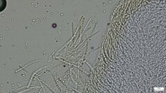 Trichoderma peltatum