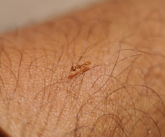 Pseudomyrmex