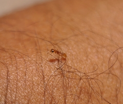 Pseudomyrmex