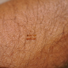 Pseudomyrmex