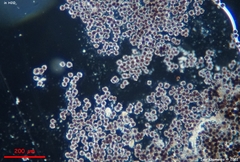 Scleroderma michiganense