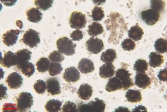 Scleroderma michiganense