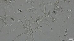 Sirobasidium magnum