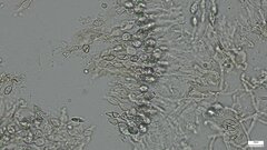 Sirobasidium magnum
