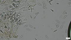 Sirobasidium magnum