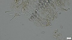Sirobasidium magnum