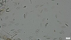 Sirobasidium magnum