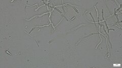 Sirobasidium magnum